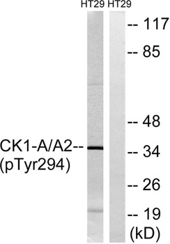 Casein Kinase Iα (phospho Tyr294) rabbit pAb Antibody