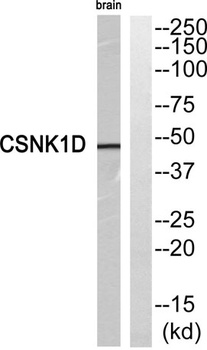 Casein Kinase Iδ rabbit pAb Antibody