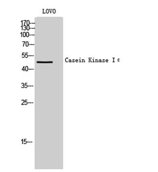Casein Kinase Iε rabbit pAb Antibody
