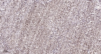 Casein Kinase IIα (phospho Tyr255) rabbit pAb Antibody