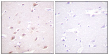 Casein Kinase IIβ (phospho Ser209) rabbit pAb Antibody