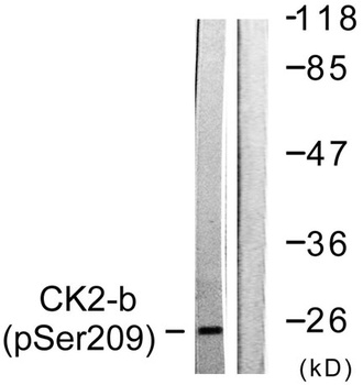 Casein Kinase IIβ (phospho Ser209) rabbit pAb Antibody