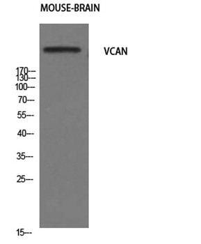Versican rabbit pAb Antibody