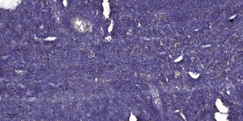 Versican rabbit pAb Antibody