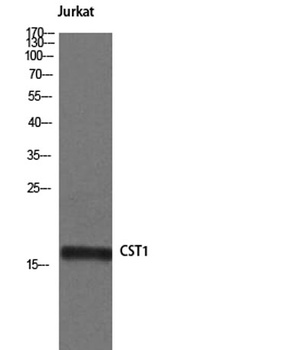 Cystatin SN rabbit pAb Antibody
