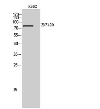 ZNF420 rabbit pAb Antibody