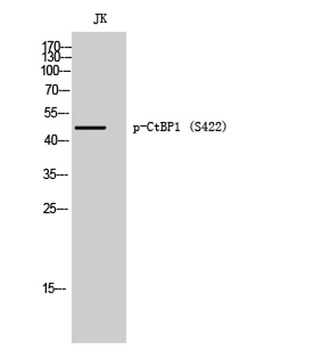 CtBP1 (phospho Ser422) rabbit pAb Antibody