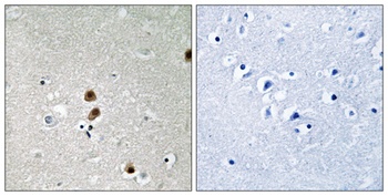 CtBP1 (phospho Ser422) rabbit pAb Antibody