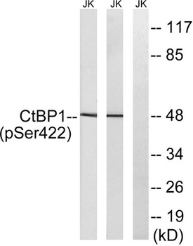 CtBP1 (phospho Ser422) rabbit pAb Antibody