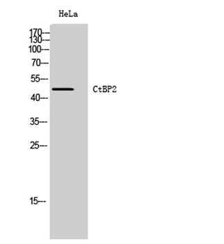 CtBP2 rabbit pAb Antibody