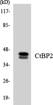 CtBP2 rabbit pAb Antibody
