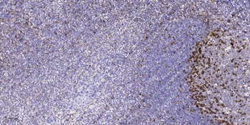 Catenin-α1 (phospho Ser641) rabbit pAb Antibody
