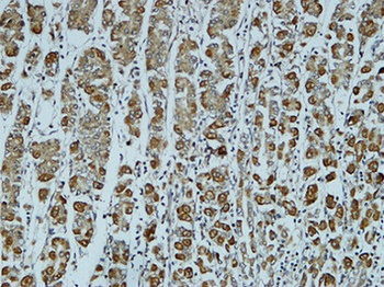 Catenin-α1 rabbit pAb Antibody