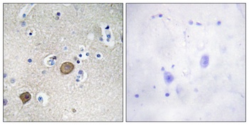 Catenin-α1 rabbit pAb Antibody