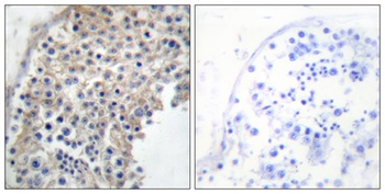 AR α2A rabbit pAb Antibody