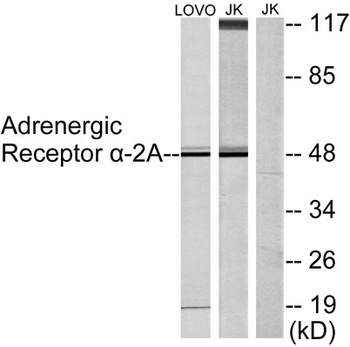AR α2A rabbit pAb Antibody