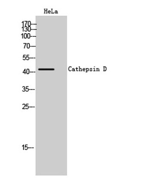 Cathepsin D rabbit pAb Antibody
