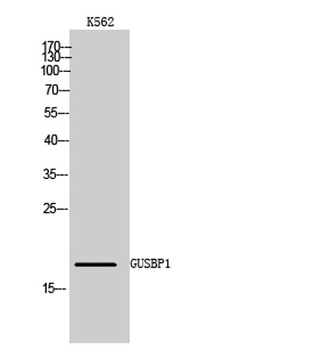 GUSBP1 rabbit pAb Antibody
