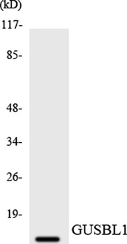 GUSBP1 rabbit pAb Antibody