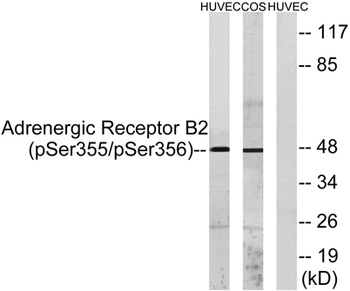 AR-β2 (phospho Ser355/S356) rabbit pAb Antibody