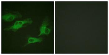 AR-β2 (phospho Ser346) rabbit pAb Antibody