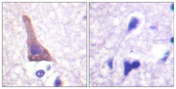 AR-β2 (phospho Ser346) rabbit pAb Antibody