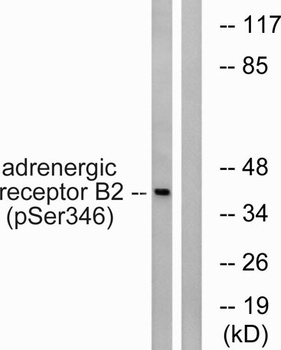 AR-β2 (phospho Ser346) rabbit pAb Antibody