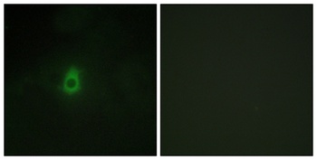 CYP2E1 rabbit pAb Antibody