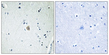 CYP2E1 rabbit pAb Antibody