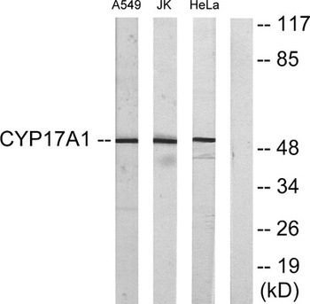 CYP17A1 rabbit pAb Antibody