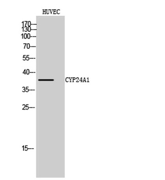 CYP24A1 rabbit pAb Antibody