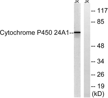 CYP24A1 rabbit pAb Antibody