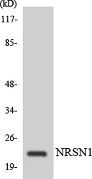 CYP24A1 rabbit pAb Antibody