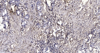 CYP24A1 rabbit pAb Antibody