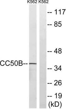 Cdc50B rabbit pAb Antibody