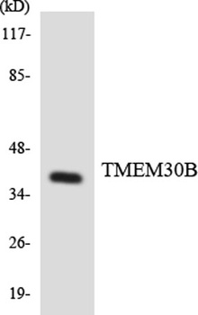 Cdc50B rabbit pAb Antibody