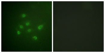 DAPK3 (phospho Thr265) rabbit pAb Antibody