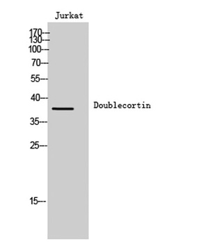 Doublecortin rabbit pAb Antibody
