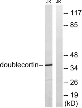 Doublecortin rabbit pAb Antibody