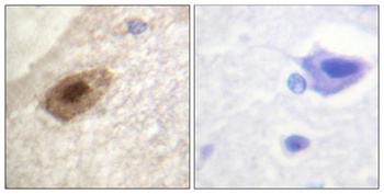 DDX3 (phospho Thr322) rabbit pAb Antibody