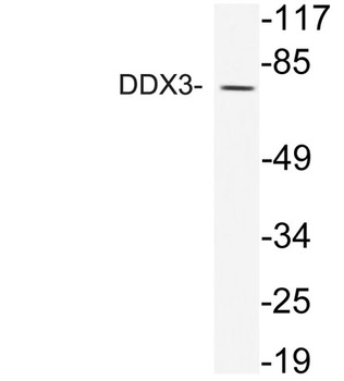 DDX3 rabbit pAb Antibody