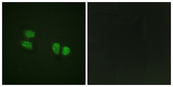 p68 RNA Helicase (phospho Tyr593) rabbit pAb Antibody