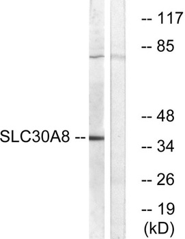 ZnT-8 rabbit pAb Antibody