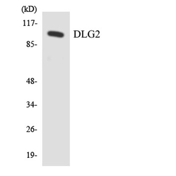 PSD-93 rabbit pAb Antibody