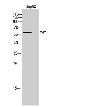 TdT rabbit pAb Antibody