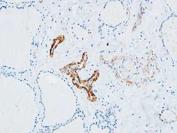 TdT rabbit pAb Antibody