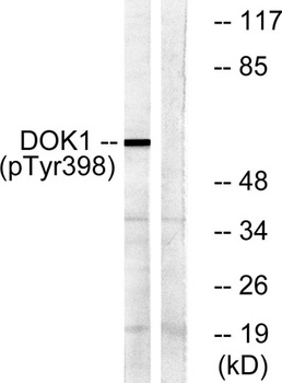 Dok-1 (phospho Tyr398) rabbit pAb Antibody