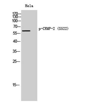 CRMP-2 (phospho Ser522) rabbit pAb Antibody