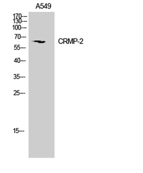 CRMP-2 rabbit pAb Antibody
