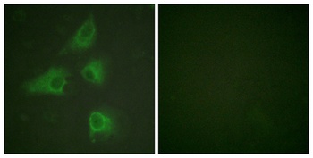 CRMP-2 rabbit pAb Antibody